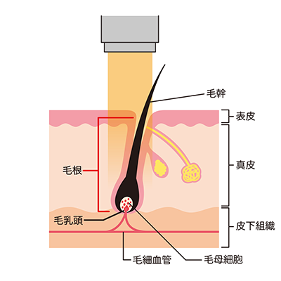 医療脱毛のメカニズム